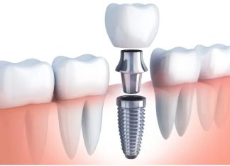 Oral Surgery: Advanced Procedures for Restoring Oral Health and Function